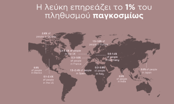  Η λεύκη επηρεάζει το 1% του πληθυσμού παγκοσμίως